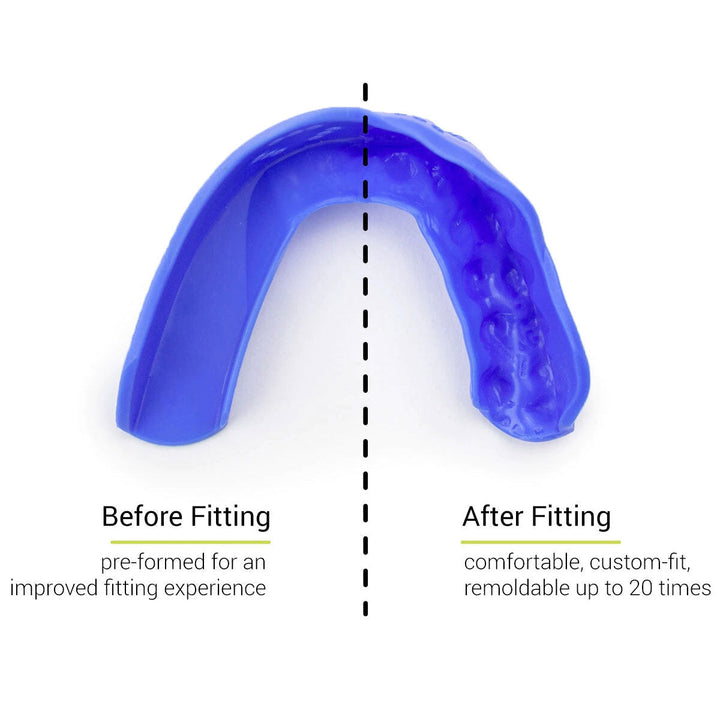 SISU 3D Mouthguard Royal Blue - Rugbystuff.com